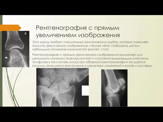 Рентгенография с прямым увеличением изображения Этот метод требует специальных рентгеновских