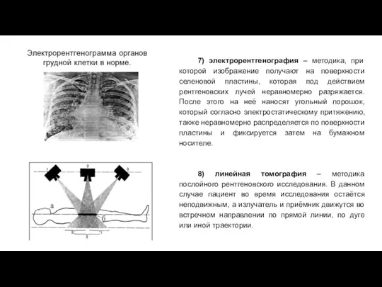 7) электрорентгенография – методика, при которой изображение получают на поверхности