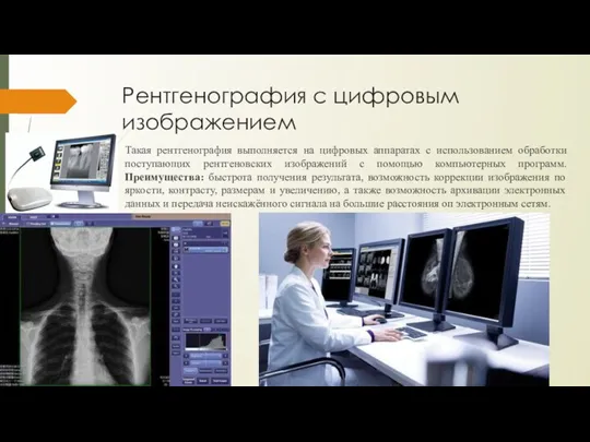 Рентгенография с цифровым изображением Такая рентгенография выполняется на цифровых аппаратах
