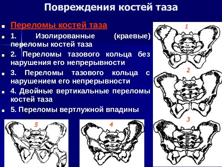 Повреждения костей таза Переломы костей таза 1. Изолированные (краевые) переломы