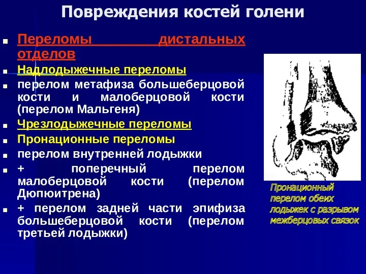 Повреждения костей голени Переломы дистальных отделов Надлодыжечные переломы перелом метафиза