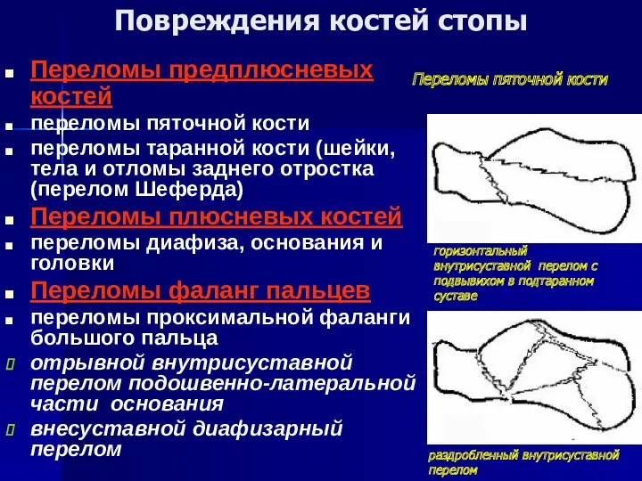 Повреждения костей стопы Переломы предплюсневых костей переломы пяточной кости переломы