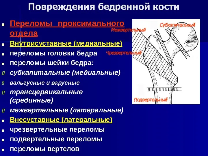 Повреждения бедренной кости Переломы проксимального отдела Внутрисуставные (медиальные) переломы головки