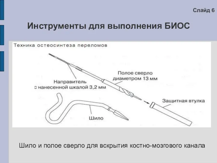 Инструменты для выполнения БИОС Шило и полое сверло для вскрытия костно-мозгового канала Слайд 6