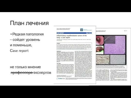 План лечения Редкая патология – сойдет уровень и поменьше, Сase report не только мнение профессора экспертов