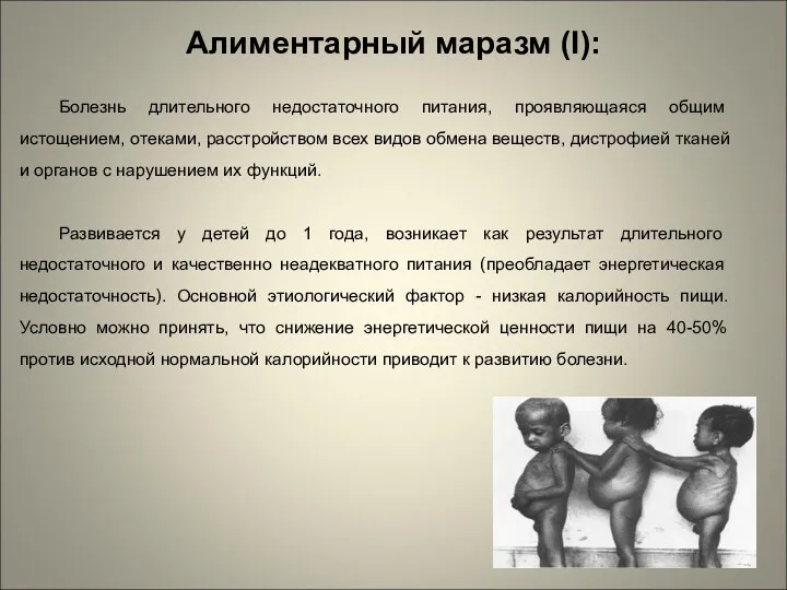 Алиментарный маразм (I): Болезнь длительного недостаточного питания, проявляющаяся общим истощением,