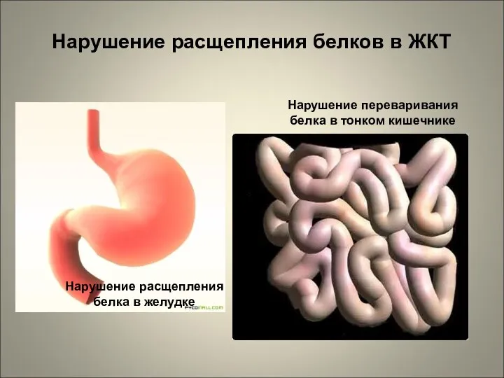 Нарушение расщепления белков в ЖКТ Нарушение расщепления белка в желудке Нарушение переваривания белка в тонком кишечнике