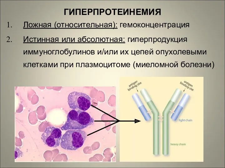 ГИПЕРПРОТЕИНЕМИЯ Ложная (относительная): гемоконцентрация Истинная или абсолютная: гиперпродукция иммуноглобулинов и/или