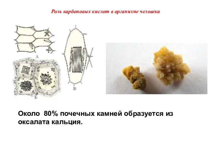 Около 80% почечных камней образуется из оксалата кальция. Роль карбоновых кислот в организме человека