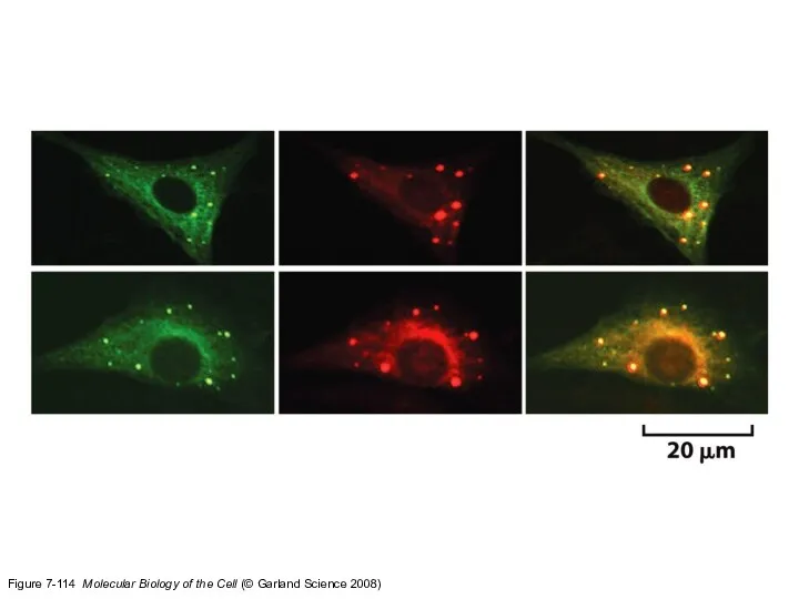 Figure 7-114 Molecular Biology of the Cell (© Garland Science 2008)