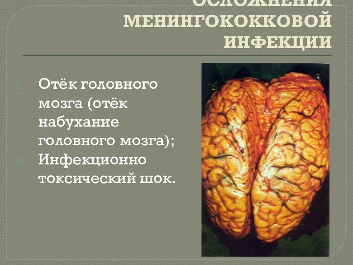 ОСЛОЖНЕНИЯ МЕНИНГОКОККОВОЙ ИНФЕКЦИИ Отёк головного мозга (отёк набухание головного мозга); Инфекционно токсический шок.