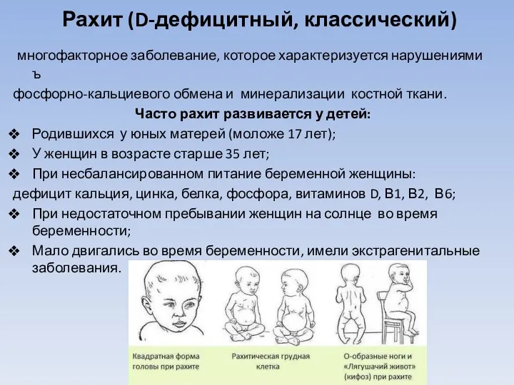 Рахит (D-дефицитный, классический) многофакторное заболевание, которое характеризуется нарушениями ъ фосфорно-кальциевого