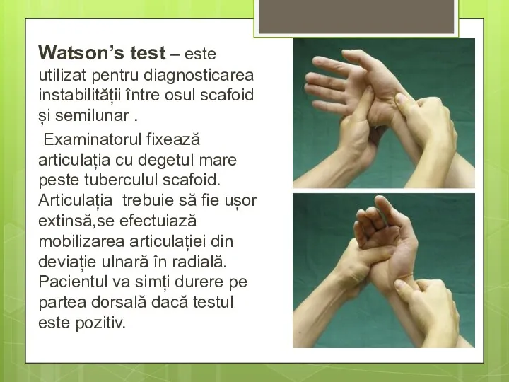 Watson’s test – este utilizat pentru diagnosticarea instabilității între osul