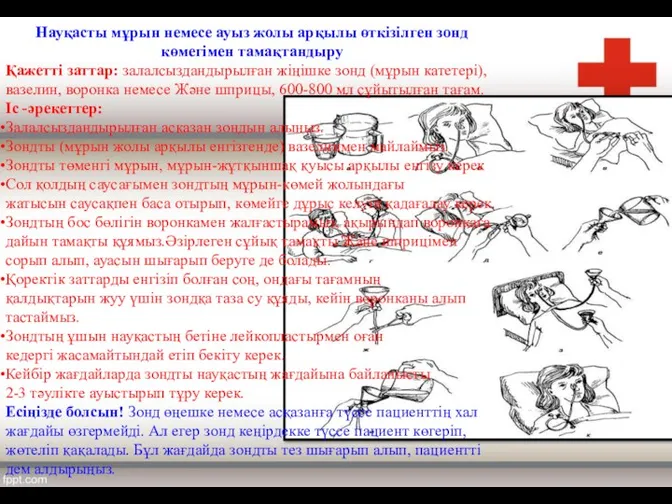 Науқасты мұрын немесе ауыз жолы арқылы өткізілген зонд көмегімен тамақтандыру