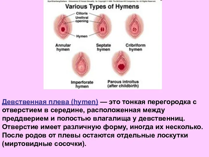 Девственная плева (hymen) — это тонкая перегородка с отверстием в