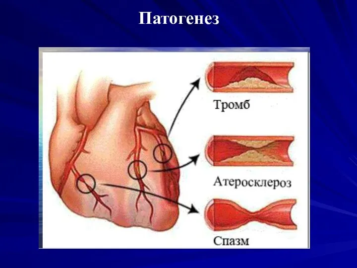 Патогенез