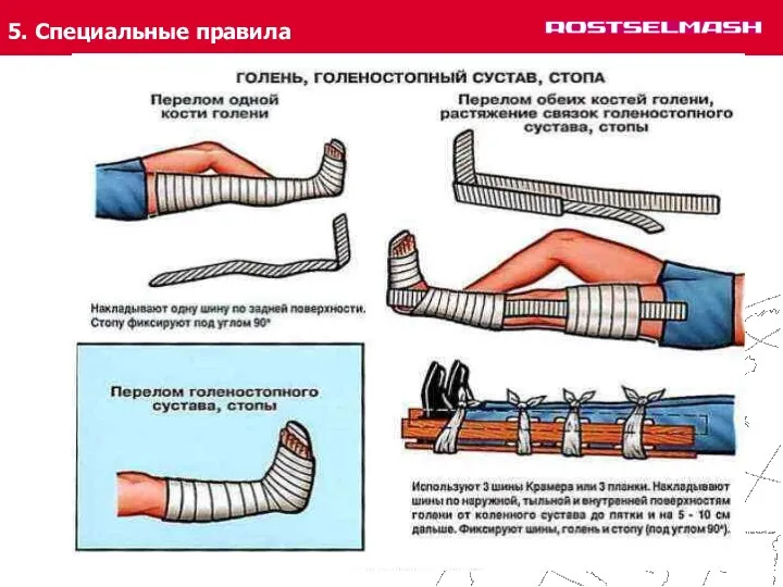 5. Специальные правила