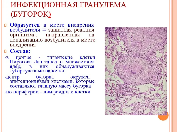 ИНФЕКЦИОННАЯ ГРАНУЛЕМА (БУГОРОК) Образуется в месте внедрения возбудителя = защитная