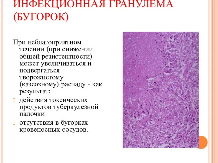 ИНФЕКЦИОННАЯ ГРАНУЛЕМА (БУГОРОК) При неблагоприятном течении (при снижении общей резистентности)