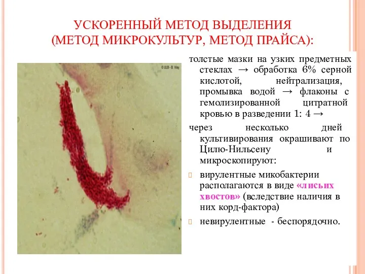 УСКОРЕННЫЙ МЕТОД ВЫДЕЛЕНИЯ (МЕТОД МИКРОКУЛЬТУР, МЕТОД ПРАЙСА): толстые мазки на