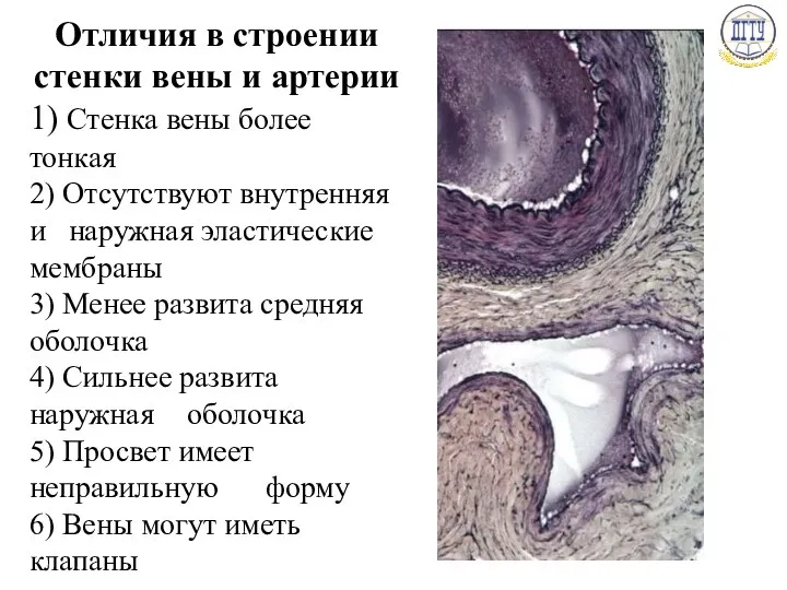 Отличия в строении стенки вены и артерии 1) Стенка вены