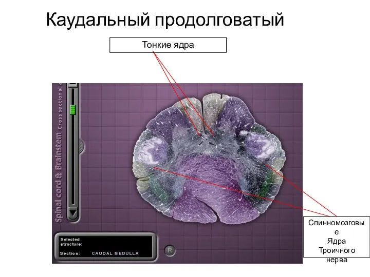 Каудальный продолговатый Тонкие ядра Спинномозговые Ядра Троичного нерва