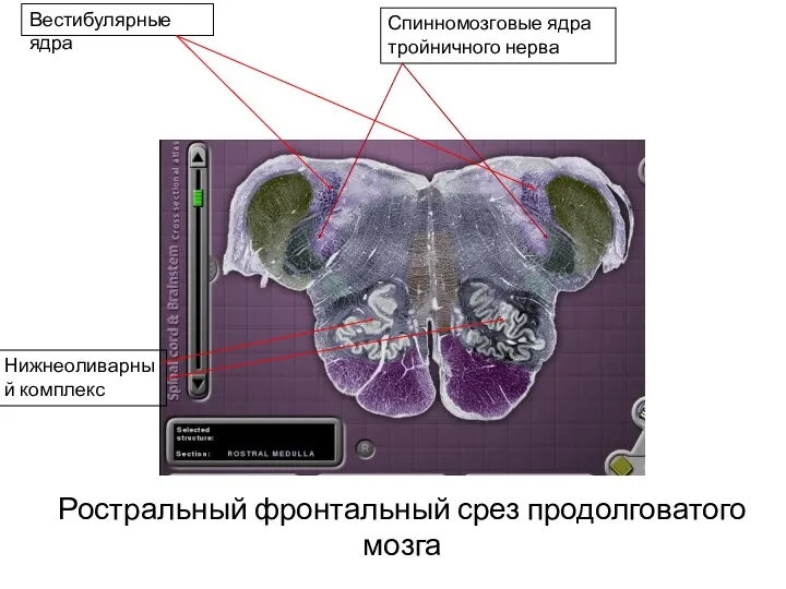 Ростральный фронтальный срез продолговатого мозга Вестибулярные ядра Спинномозговые ядра тройничного нерва Нижнеоливарный комплекс