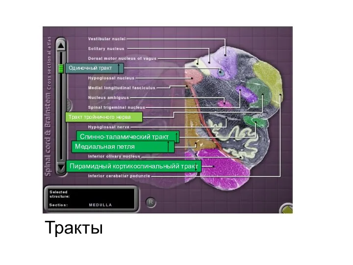 Спинно-таламический тракт Одиночный тракт Тракт тройничного нерва Тракты Пирамидный кортикоспинальныйй тракт Медиальная петля