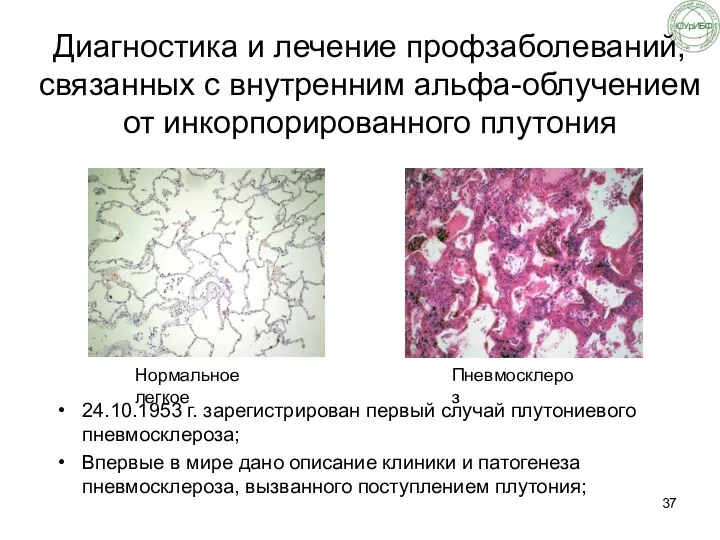 Диагностика и лечение профзаболеваний, связанных с внутренним альфа-облучением от инкорпорированного