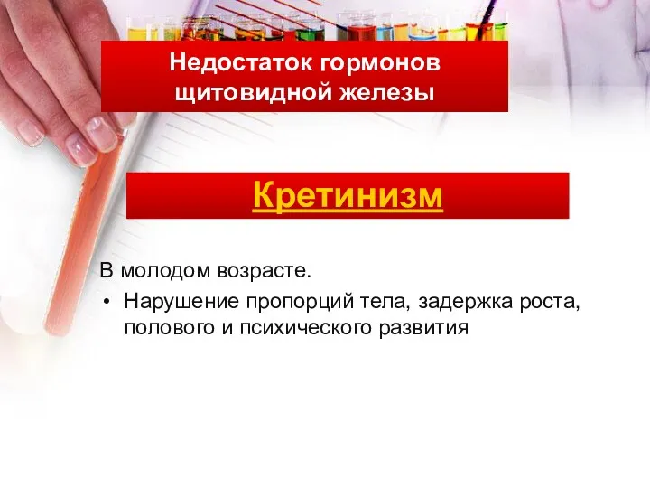 Недостаток гормонов щитовидной железы Кретинизм В молодом возрасте. Нарушение пропорций