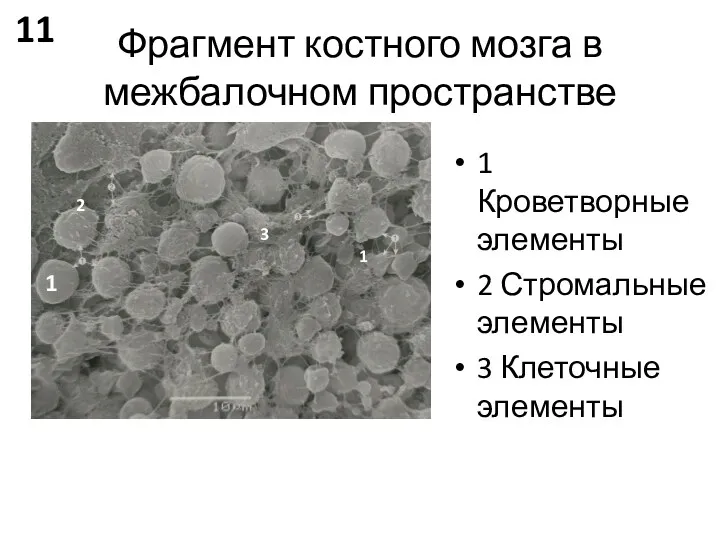 Фрагмент костного мозга в межбалочном пространстве 1 Кроветворные элементы 2