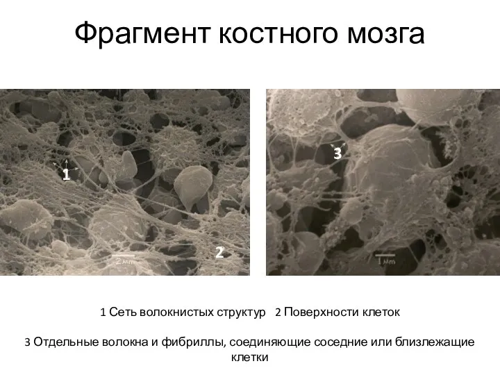 Фрагмент костного мозга 1 Сеть волокнистых структур 2 Поверхности клеток