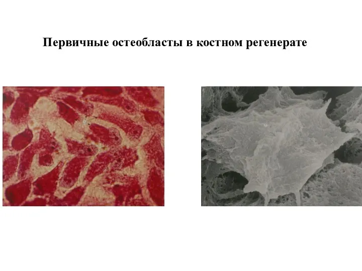 Первичные остеобласты в костном регенерате
