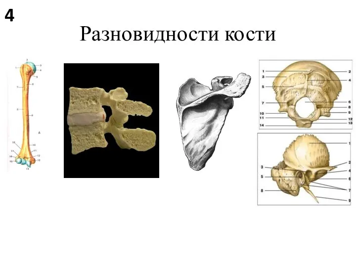 Разновидности кости 4