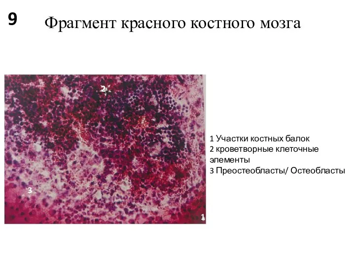 Фрагмент красного костного мозга 1 Участки костных балок 2 кроветворные