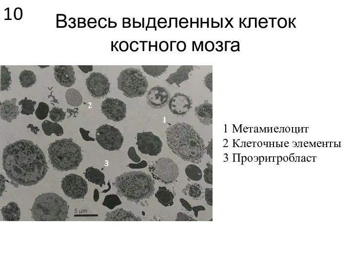 Взвесь выделенных клеток костного мозга 1 Метамиелоцит 2 Клеточные элементы 3 Проэритробласт 3 1 2 10