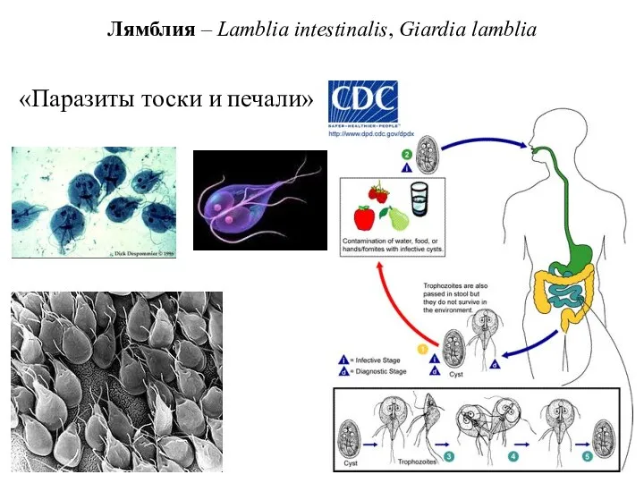 Лямблия – Lamblia intestinalis, Giardia lamblia «Паразиты тоски и печали»
