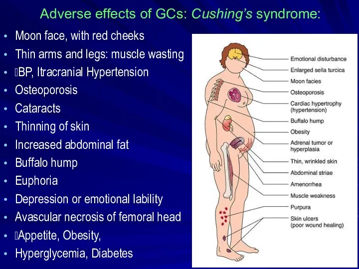 Adverse effects of GCs: Cushing’s syndrome: Moon face, with red cheeks Thin arms