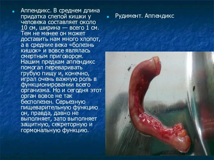 Аппендикс. В среднем длина придатка слепой кишки у человека составляет