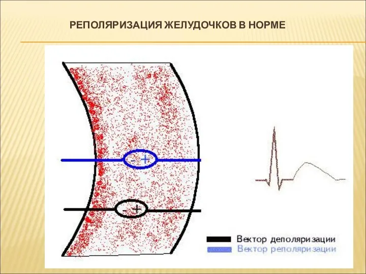 РЕПОЛЯРИЗАЦИЯ ЖЕЛУДОЧКОВ В НОРМЕ