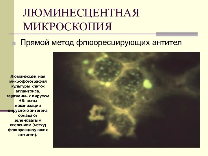 ЛЮМИНЕСЦЕНТНАЯ МИКРОСКОПИЯ Прямой метод флюоресцирующих антител Люминесцентная микрофотография культуры клеток аллантоиса, зараженных вирусом