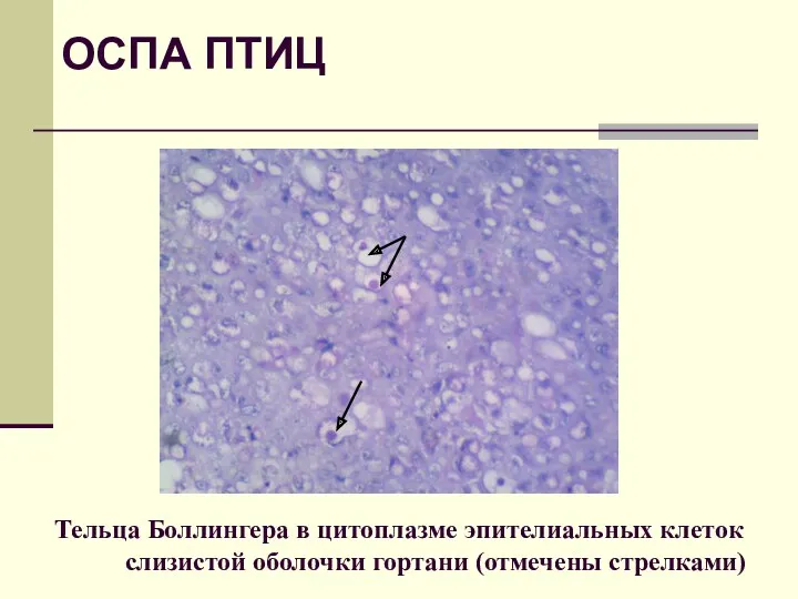Тельца Боллингера в цитоплазме эпителиальных клеток слизистой оболочки гортани (отмечены стрелками) ОСПА ПТИЦ