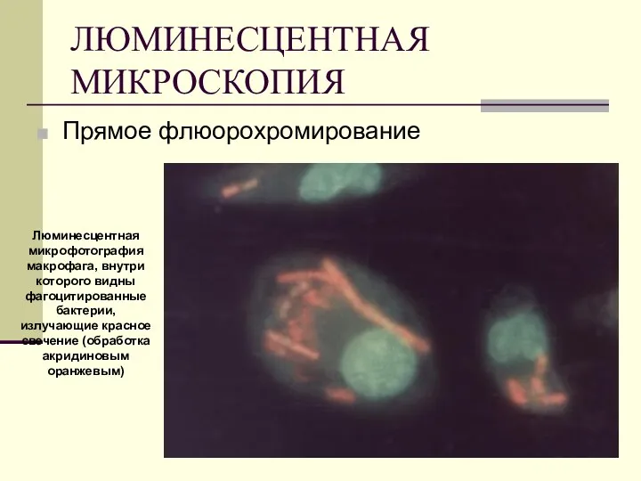 ЛЮМИНЕСЦЕНТНАЯ МИКРОСКОПИЯ Прямое флюорохромирование Люминесцентная микрофотография макрофага, внутри которого видны фагоцитированные бактерии, излучающие