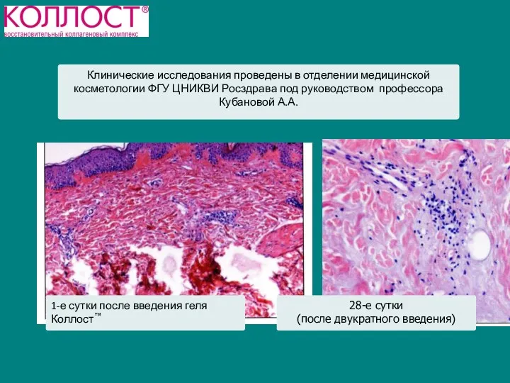 Клинические исследования проведены в отделении медицинской косметологии ФГУ ЦНИКВИ Росздрава