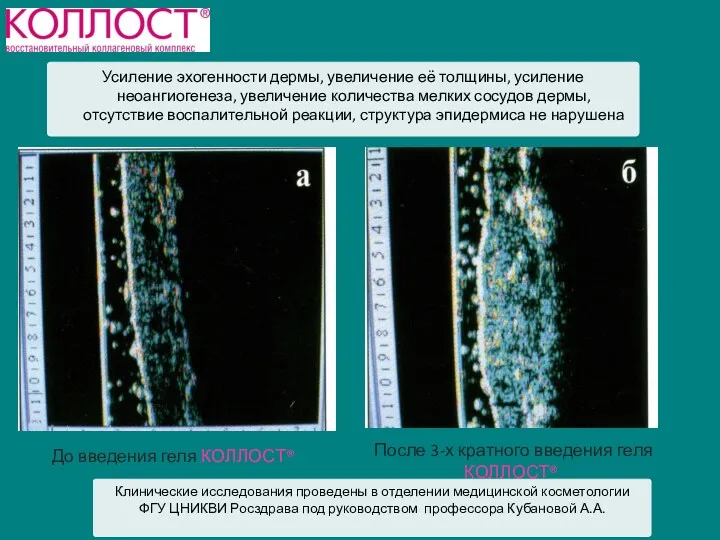 До введения геля КОЛЛОСТ® После 3-х кратного введения геля КОЛЛОСТ®