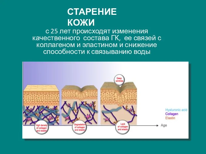 СТАРЕНИЕ КОЖИ с 25 лет происходят изменения качественного состава ГК,