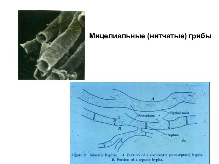 Мицелиальные (нитчатые) грибы