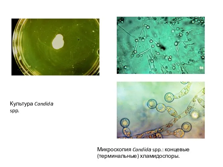 Культура Candidа spp. Микроскопия Candidа spp.: концевые (терминальные) хламидоспоры.
