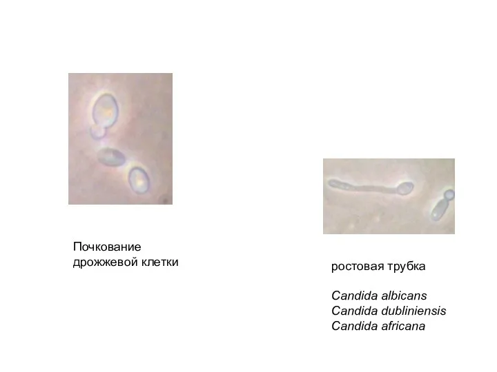 ростовая трубка Candida albicans Candida dubliniensis Candida africana Почкование дрожжевой клетки