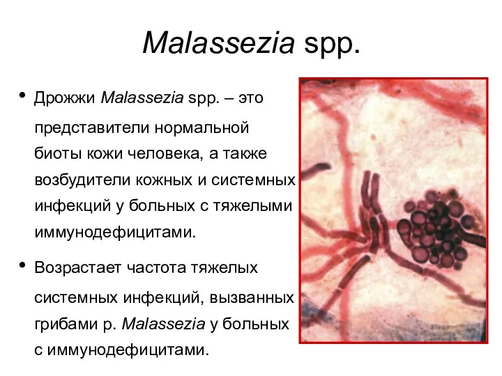 Malassezia spp. Дрожжи Malassezia spp. – это представители нормальной биоты кожи человека, а